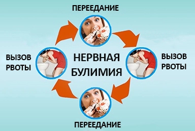 Лечение булимии в Херсоне